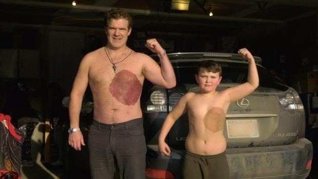 Canadian dad gets tattoo for son