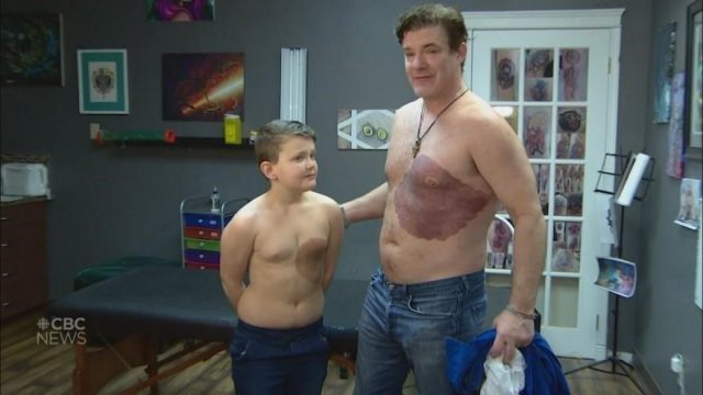 Caring dad gets tattoo of his self conscious sons birthmark